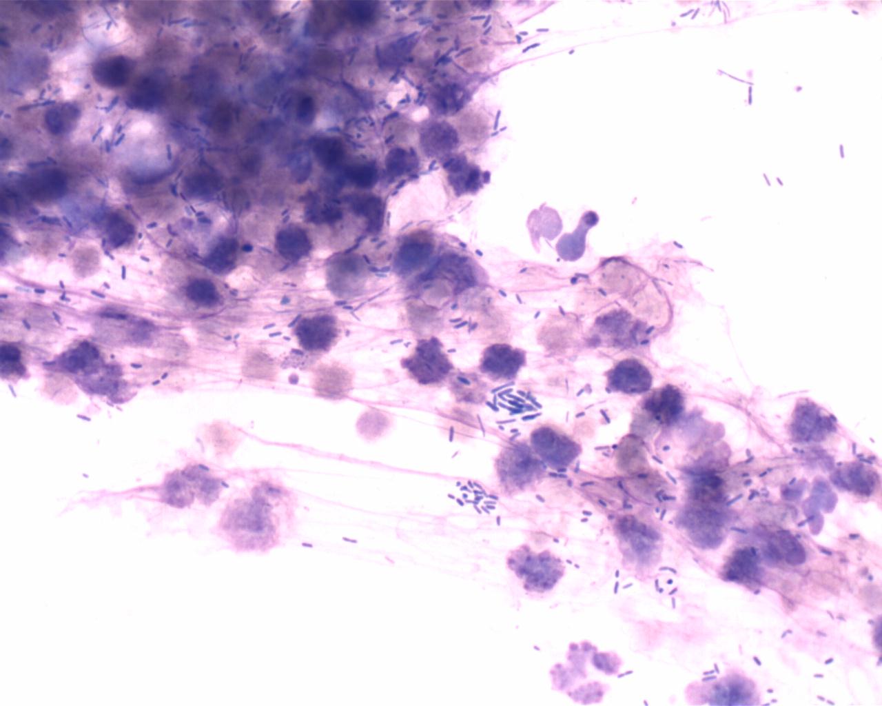 Anidap Cytology Anal Sac Inflammation With Bacteria